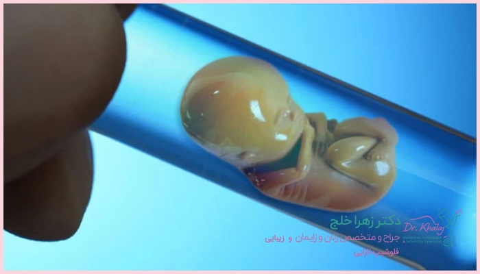 ورزش کردن بعد از IVF