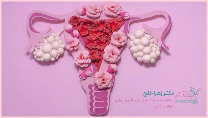 درمان نارسایی تخمدان
