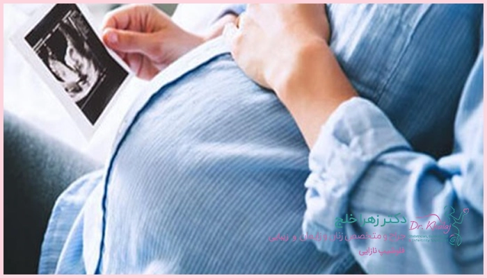 نکات مراقبتی بعد از ناباروری به روش GIFT