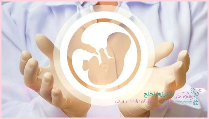 کمک باروری به روش ZIFT چه معایبی دارد؟